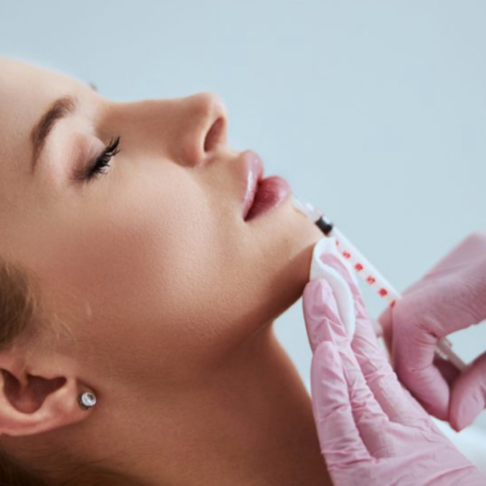 Dermal Filler at Aesthetik Nurse Kat in Riverside, CA
