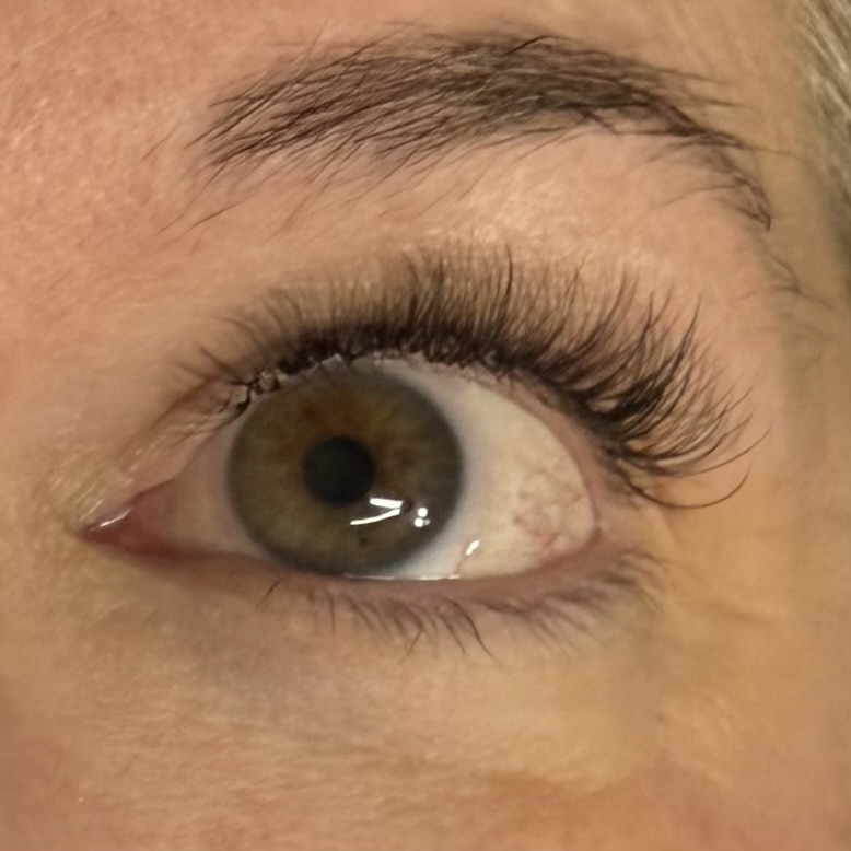 Hybrid Refill