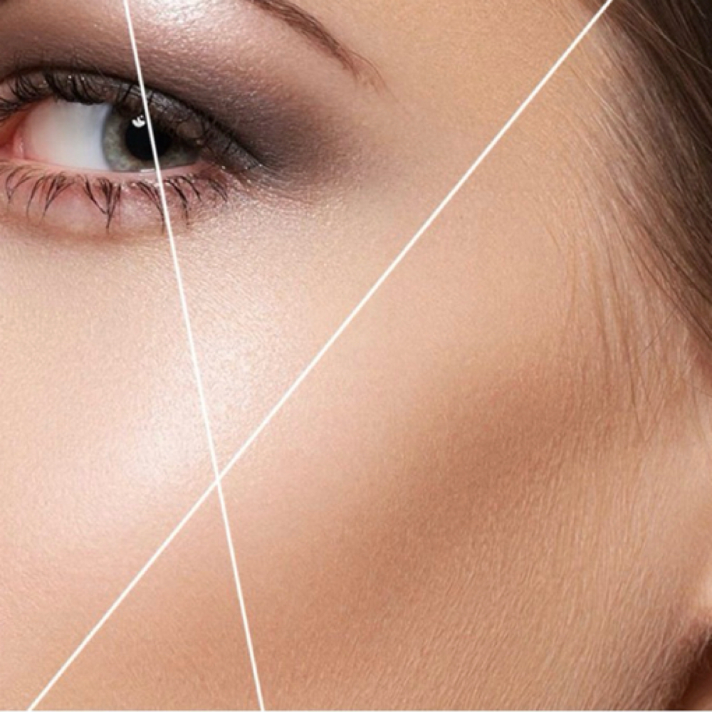 Cheeks Threading at Merve Hyde Beauty in San Antonio, TX