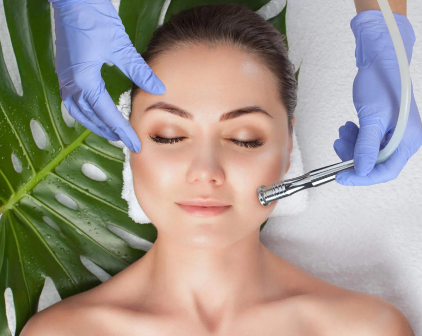 Microdermabrasion