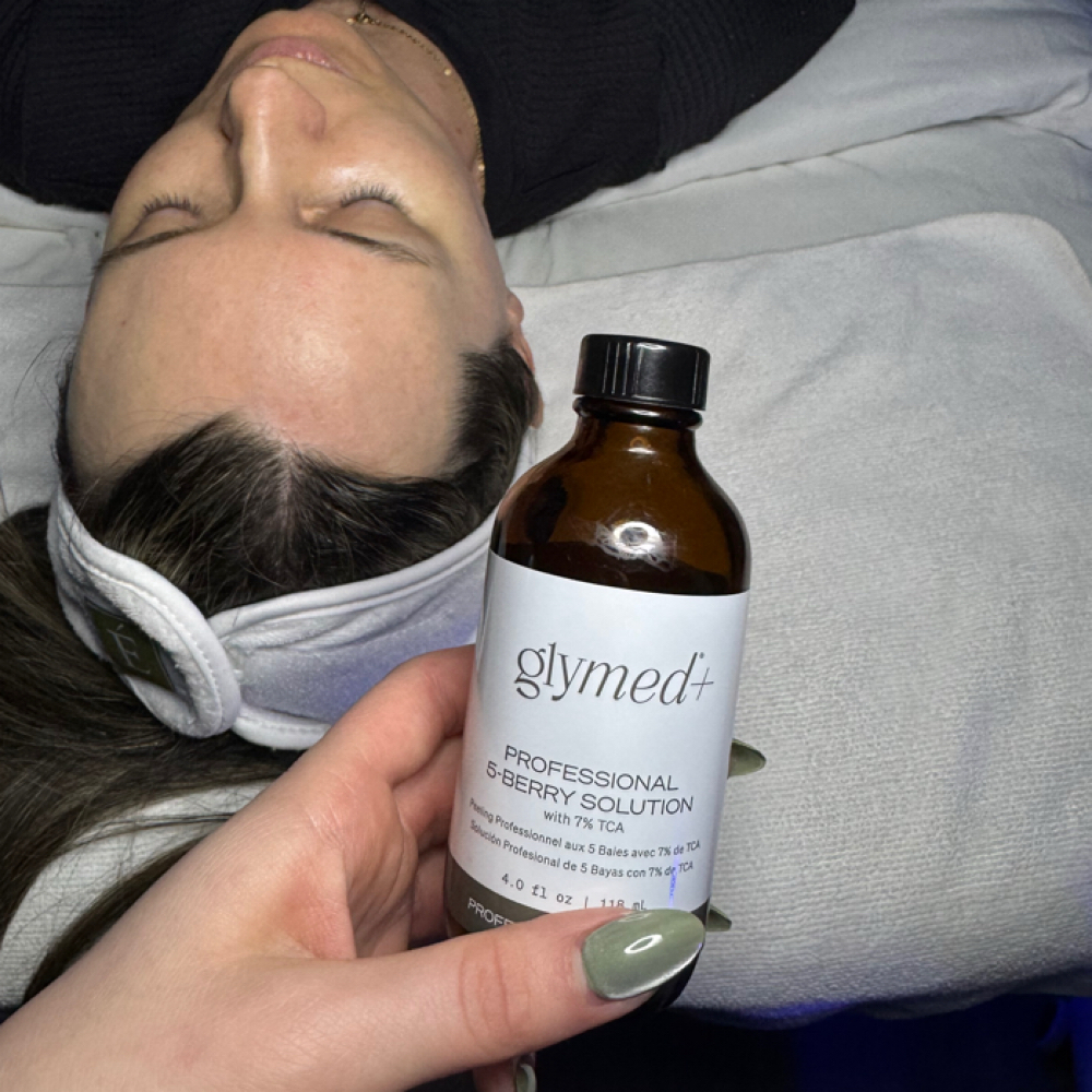 Chemical Peel Facial at Skinfinity & Beyond in Davidson, NC