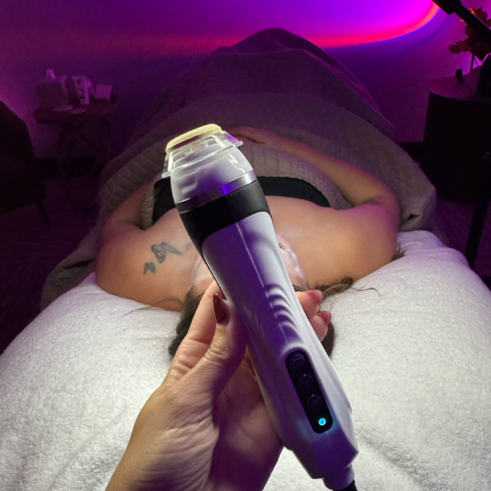 Glow O2 Facial - September Facial at LB SKIN in Minot, ND