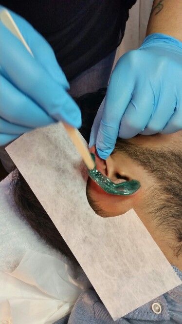 Ear Wax