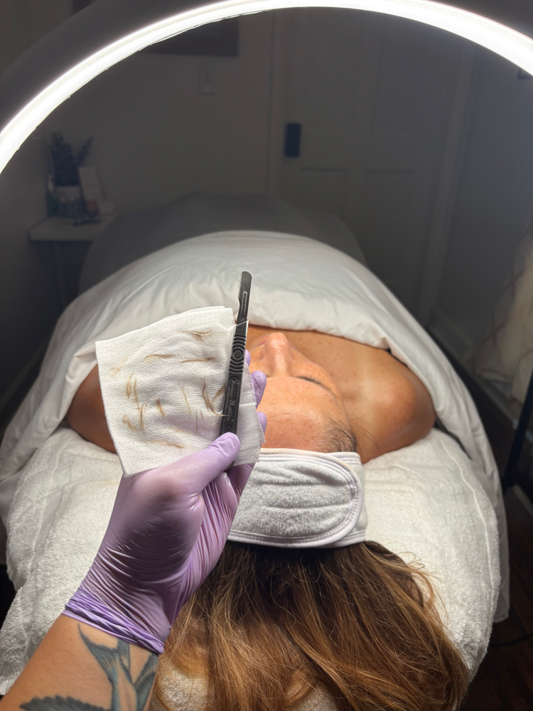 Dermaplane Add On