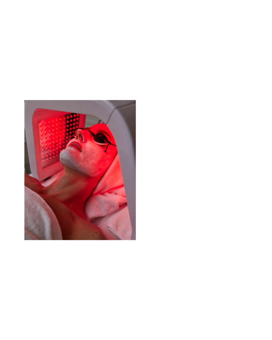 LED Light Therapy (Add on)
