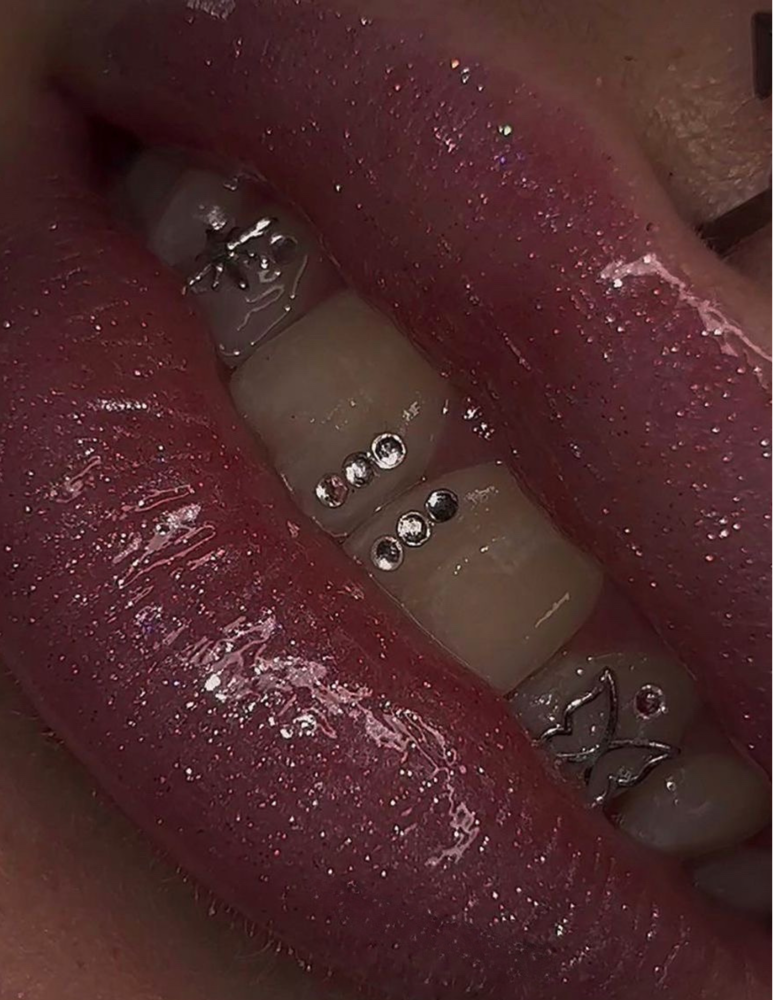 Tooth Gems