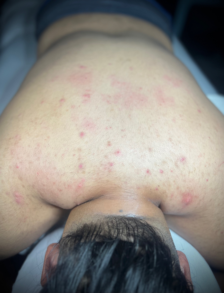 Immortal Signature Back Treatment at IMMORTALIZED BEAUTY BY ANGIE in Riverbank, CA