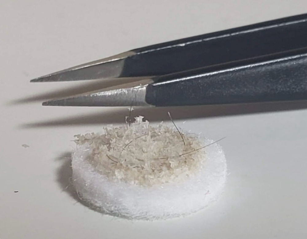 Microdermabrasion