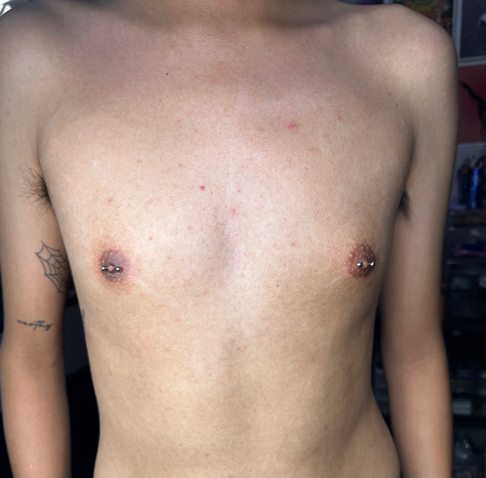 Nipple Piercings