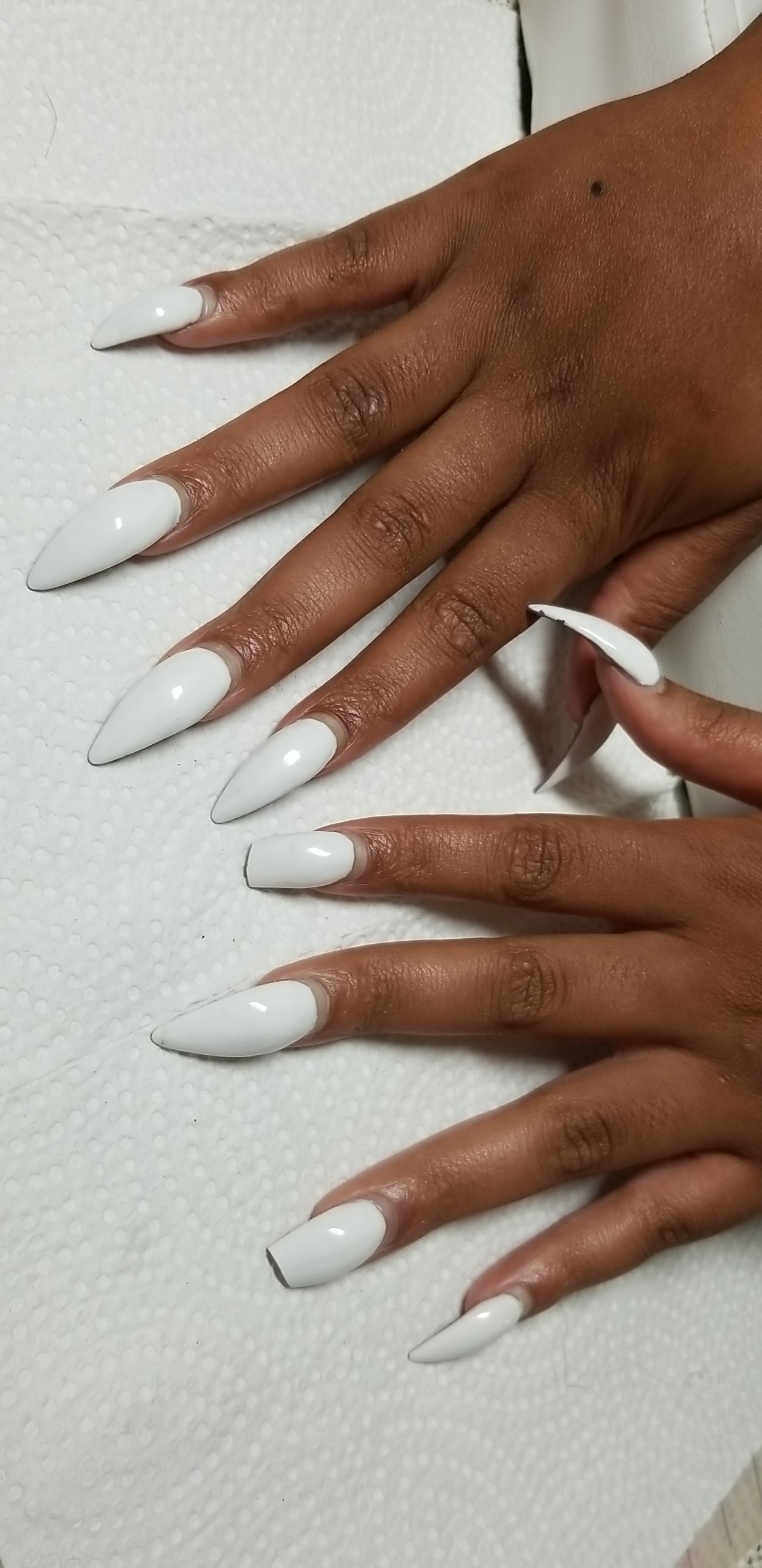 Nail repair