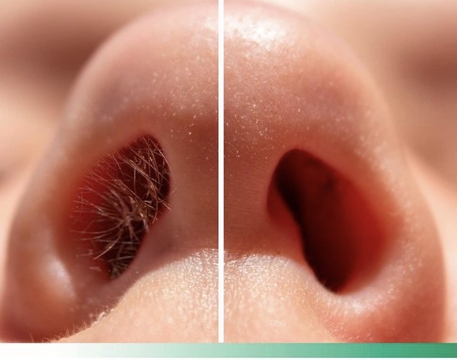 Nose Hair Wax