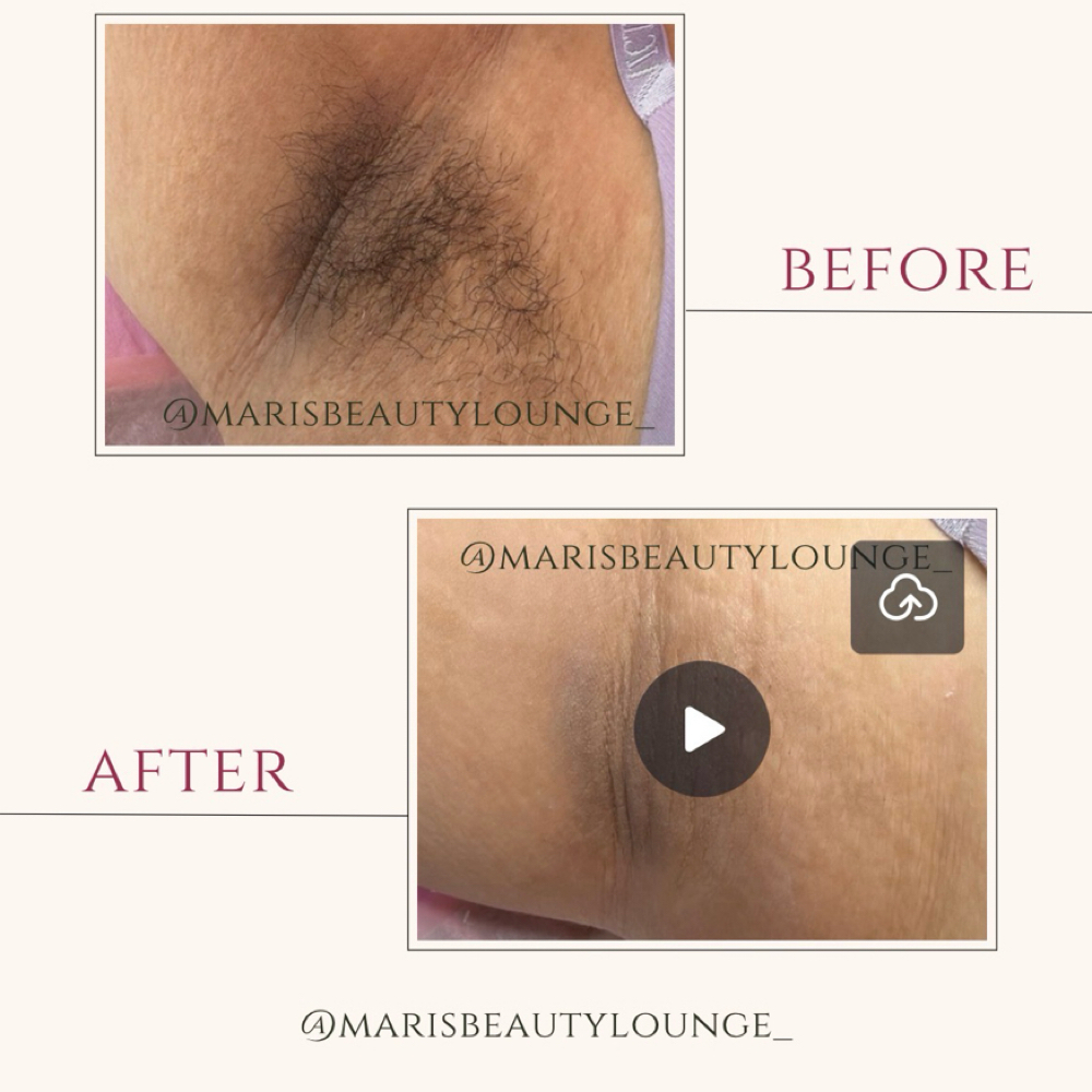 Underarms Skin Brightening at marisbeautylounge_ in Huntington Park, CA