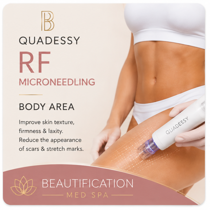 Quadessy RF Microneedling Body Area at Beautification MedSpa in Concord, CA