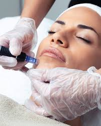 Microneedling