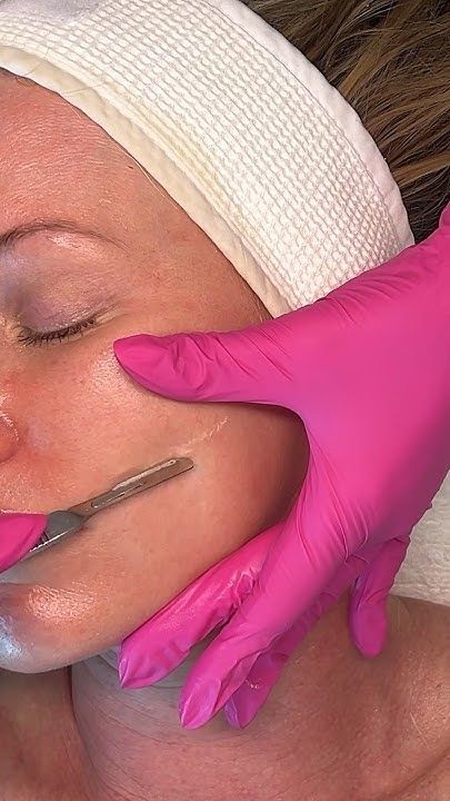 Dermaplane Treatment