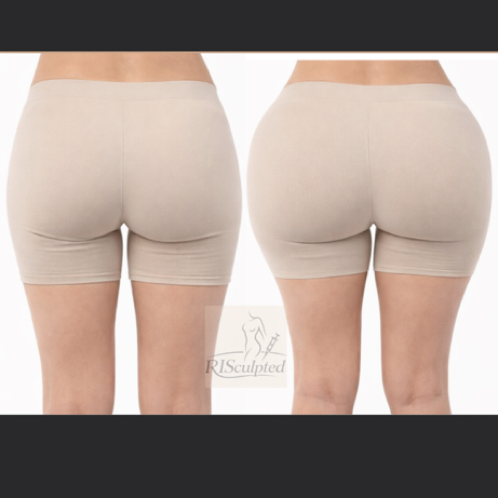 The “RisEffect” Doll (600ml) at RISculpted Aesthetics in Stockbridge, GA