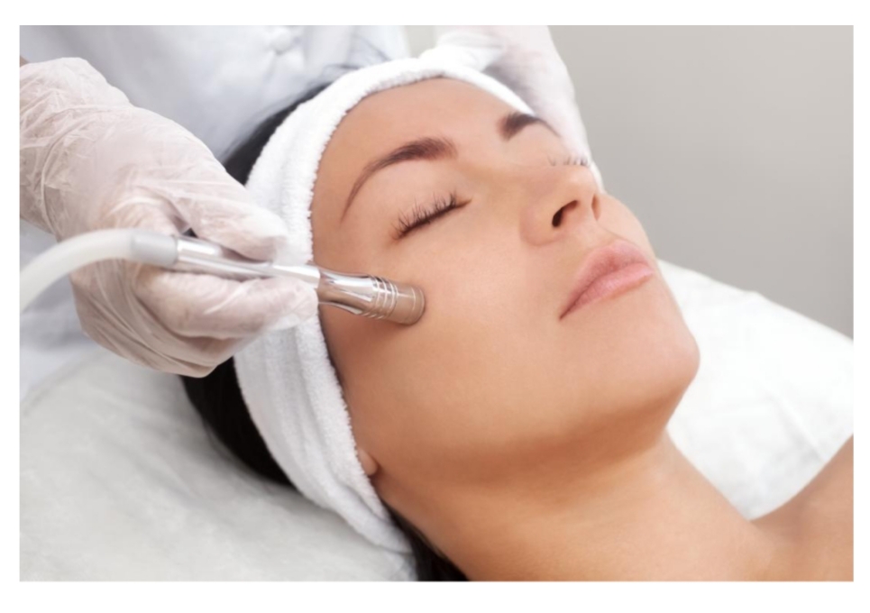 Add-on Microdermabrasion