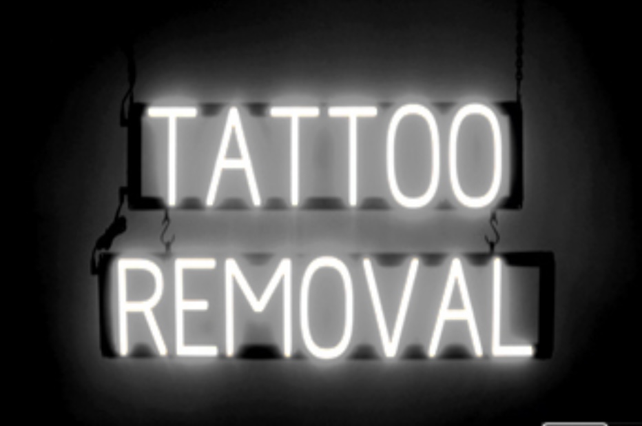 Tattoo Removal