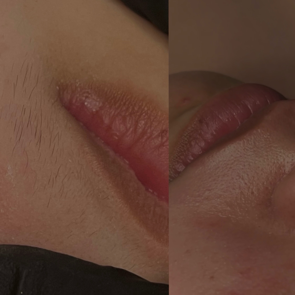 upper Lip Wax