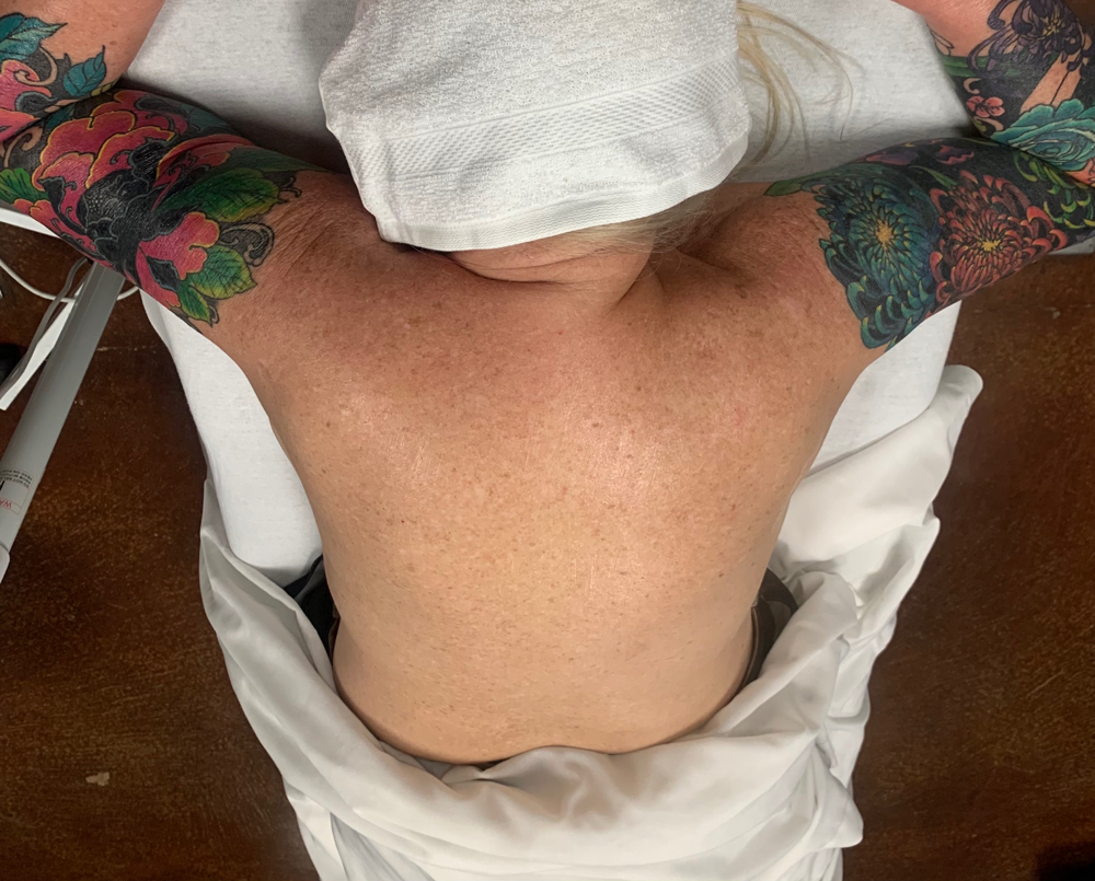 Back Facial 🧼