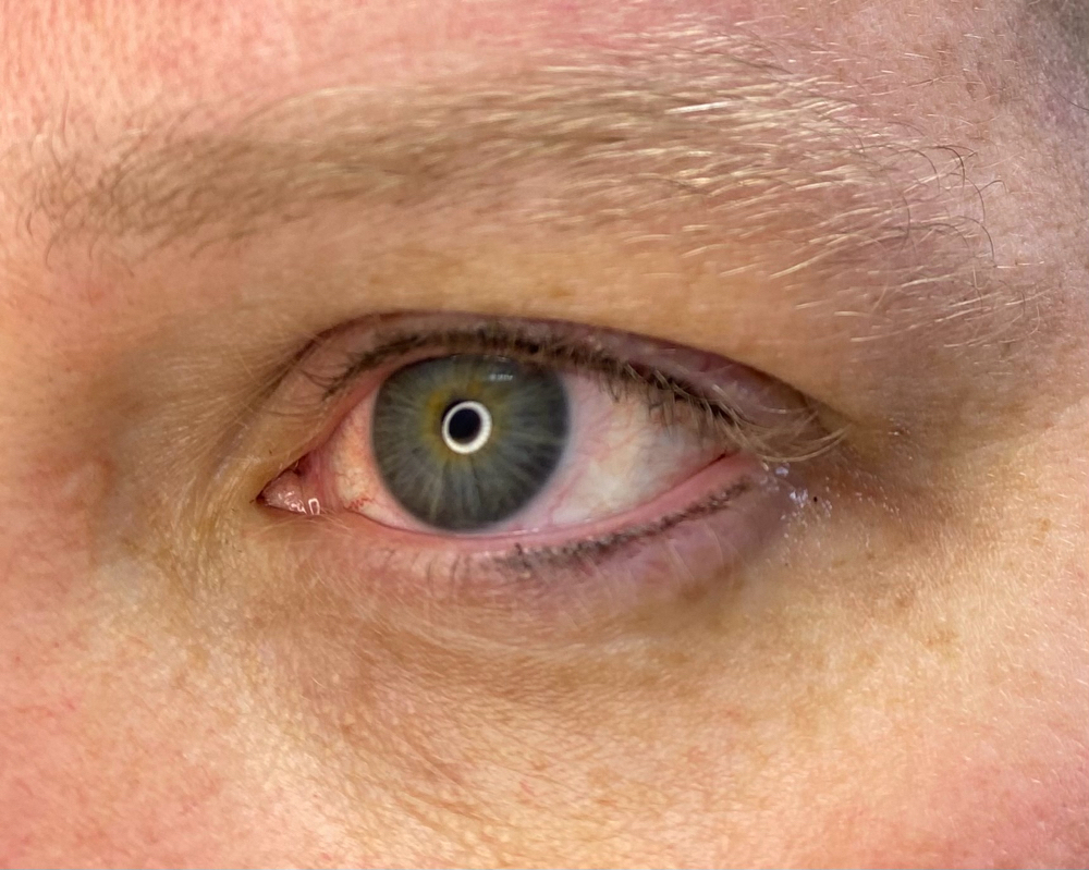 Bottom Liner