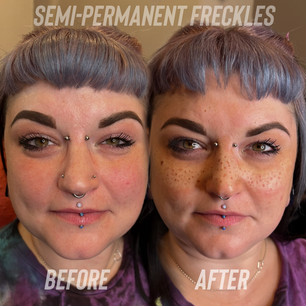 Semi-Permanent Freckles