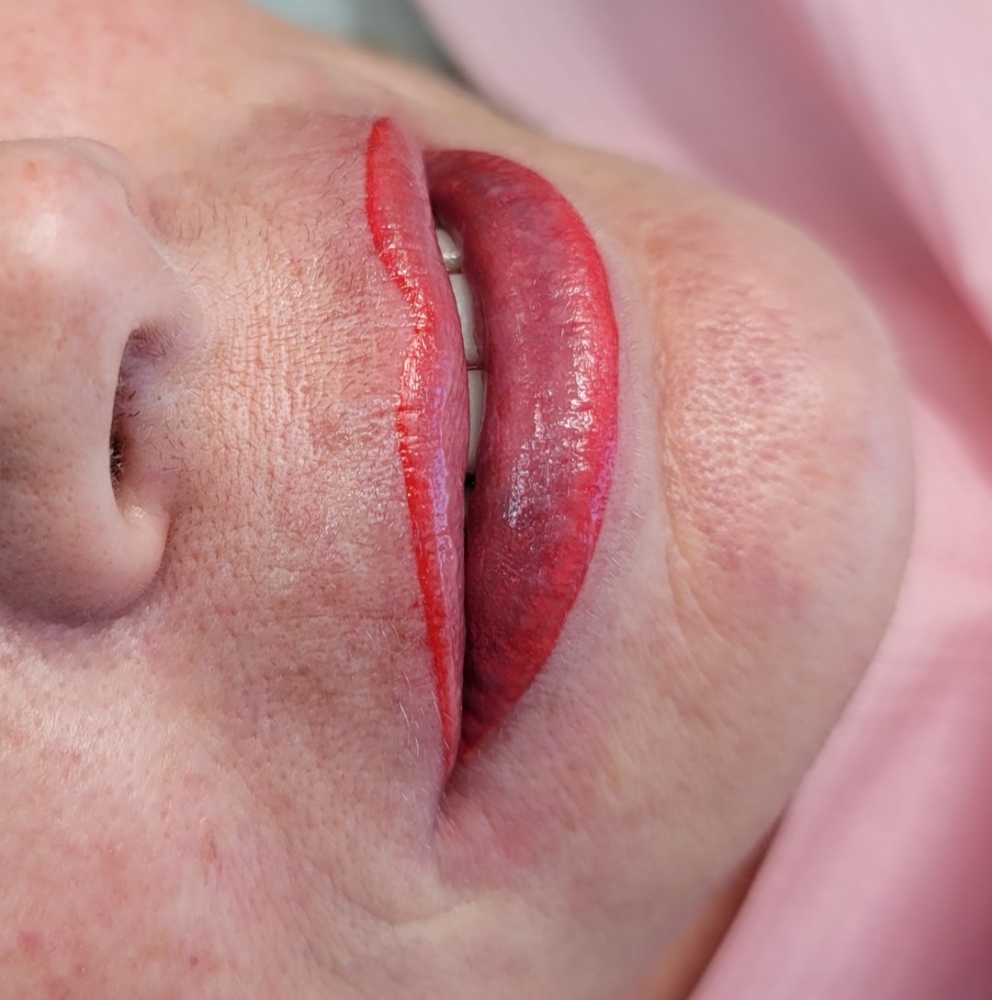 Lip Line Contour