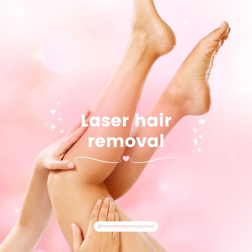 Laser Hair Removal