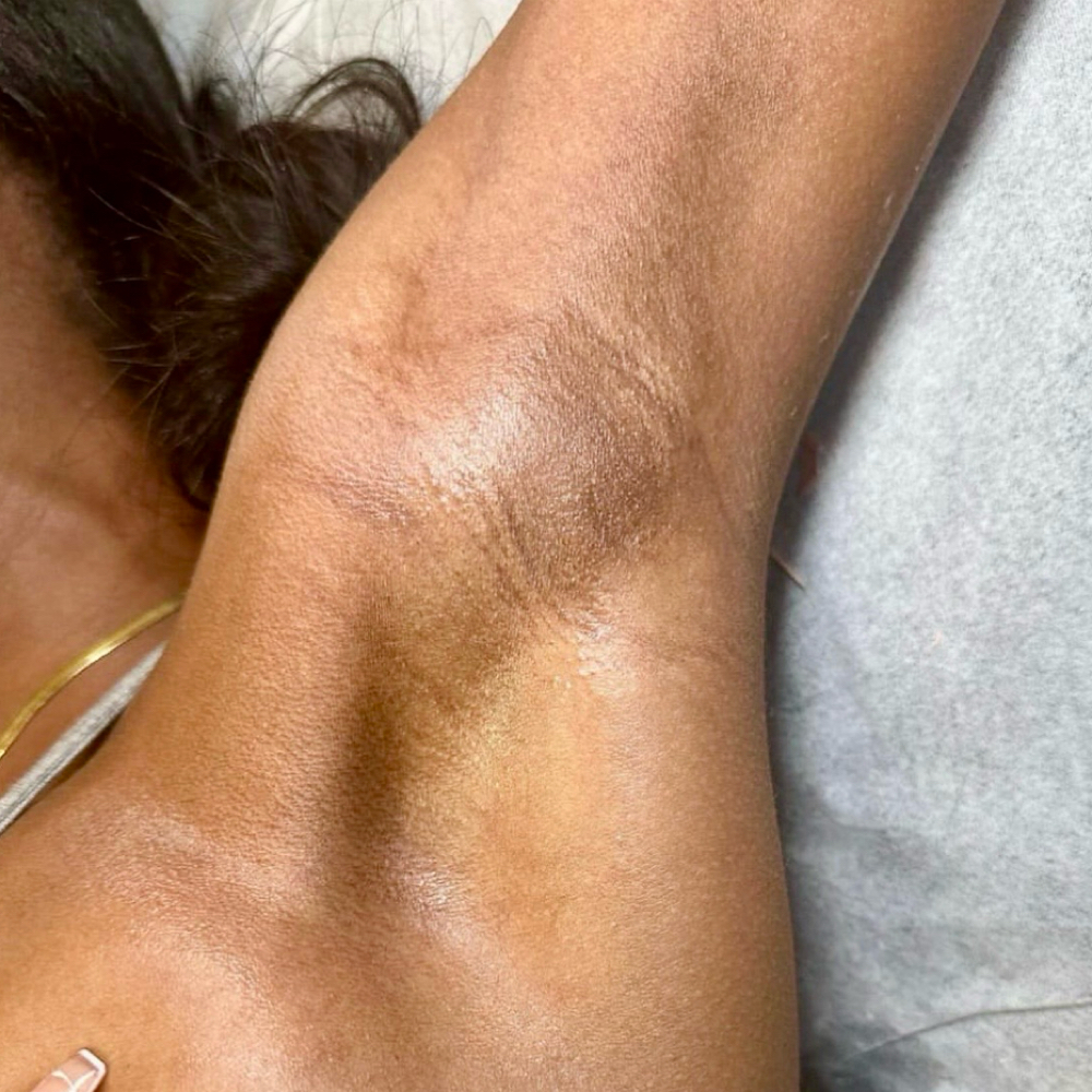 Underarm Wax at Lady Leopard Lounge in Fremont, CA