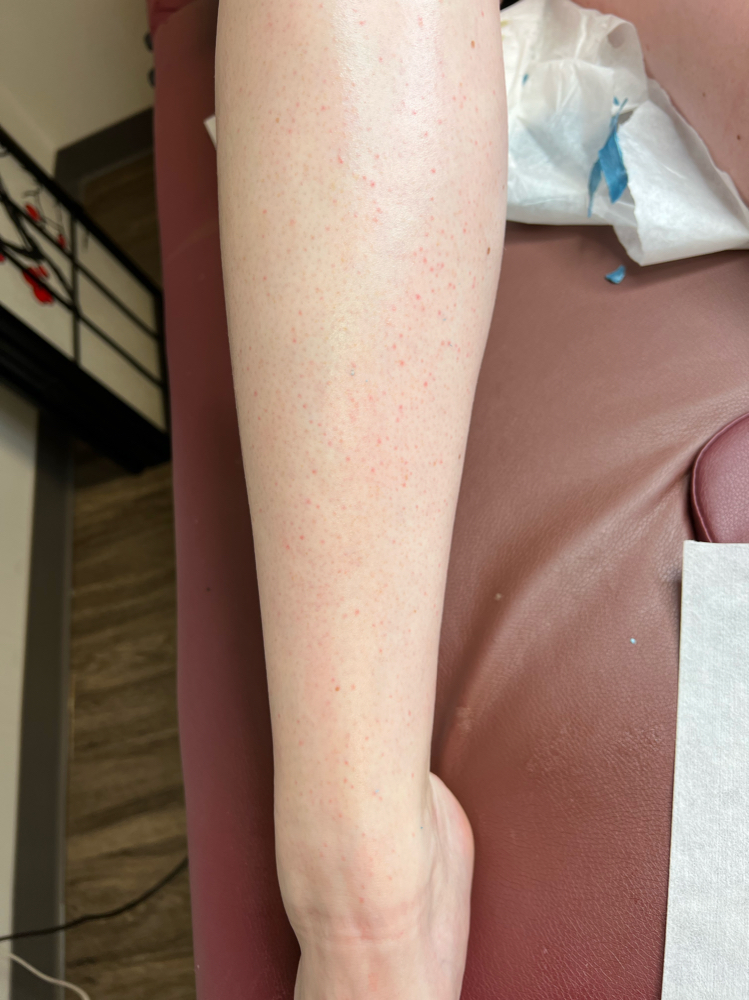 Full Leg Wax
