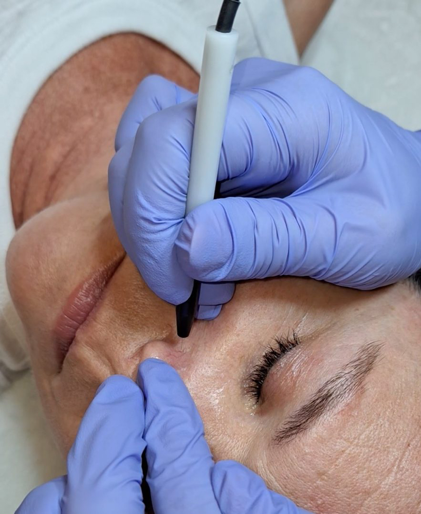 Skin Classic Treatment
