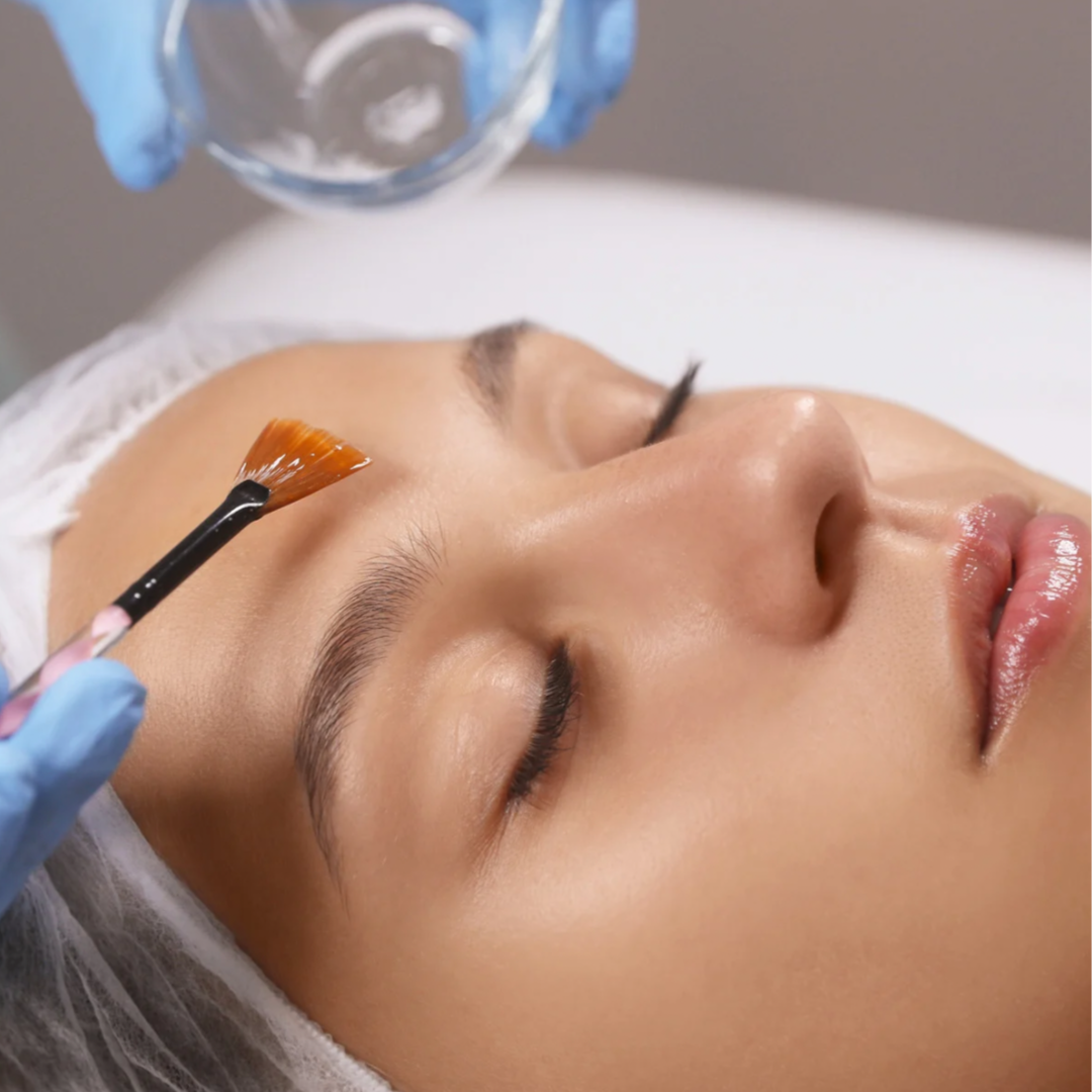 VI Peel (Face) at Luna Aesthetics in Alexandria, VA