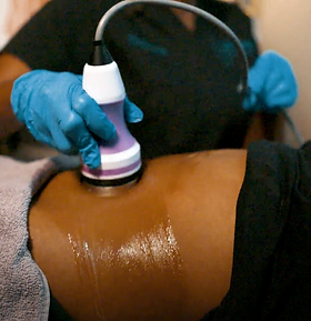 Body Sculting Services
