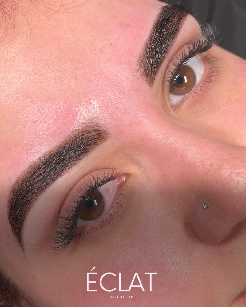 BROW REHAB