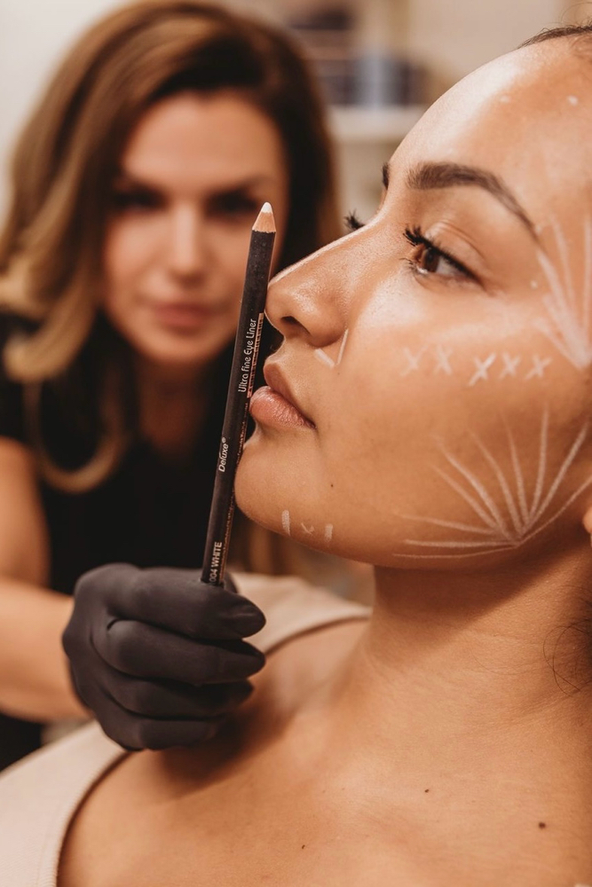 Facial Balancing | Multiple Areas