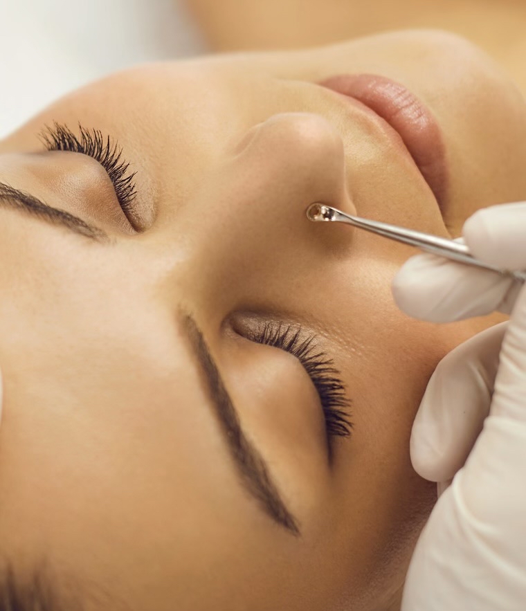 Extractions