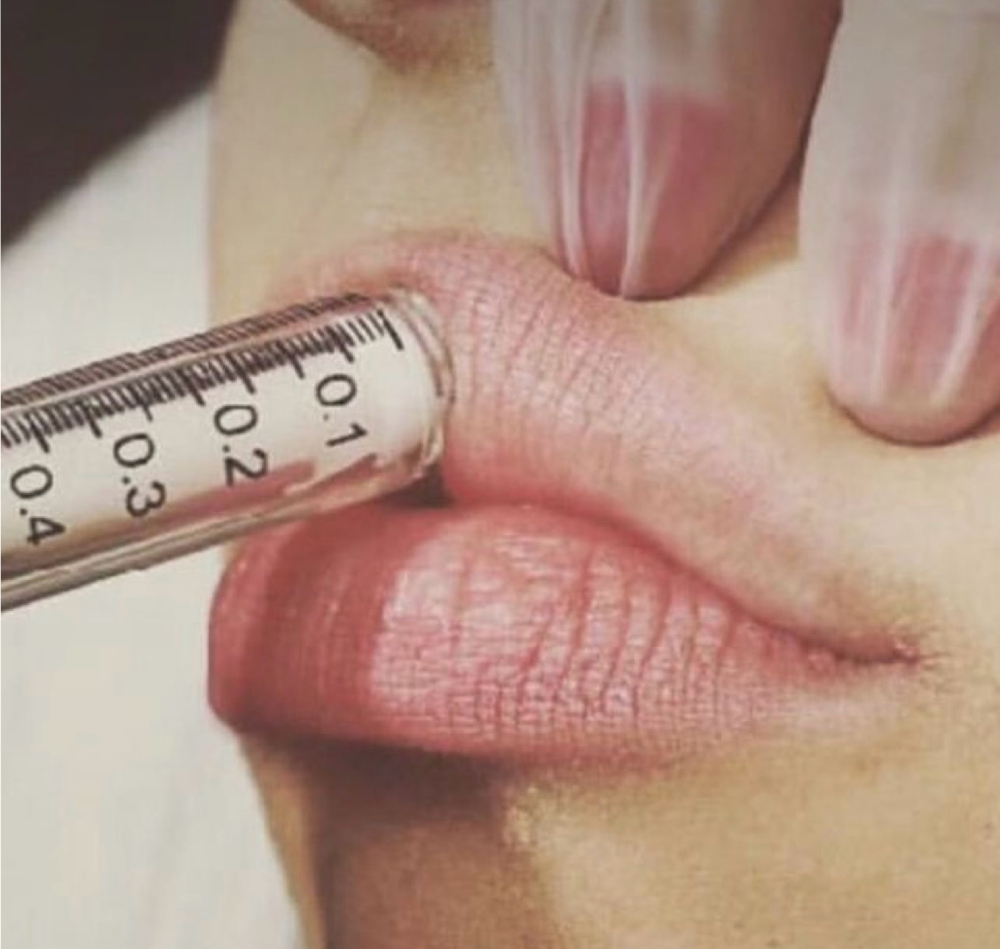 Lip Enhancement