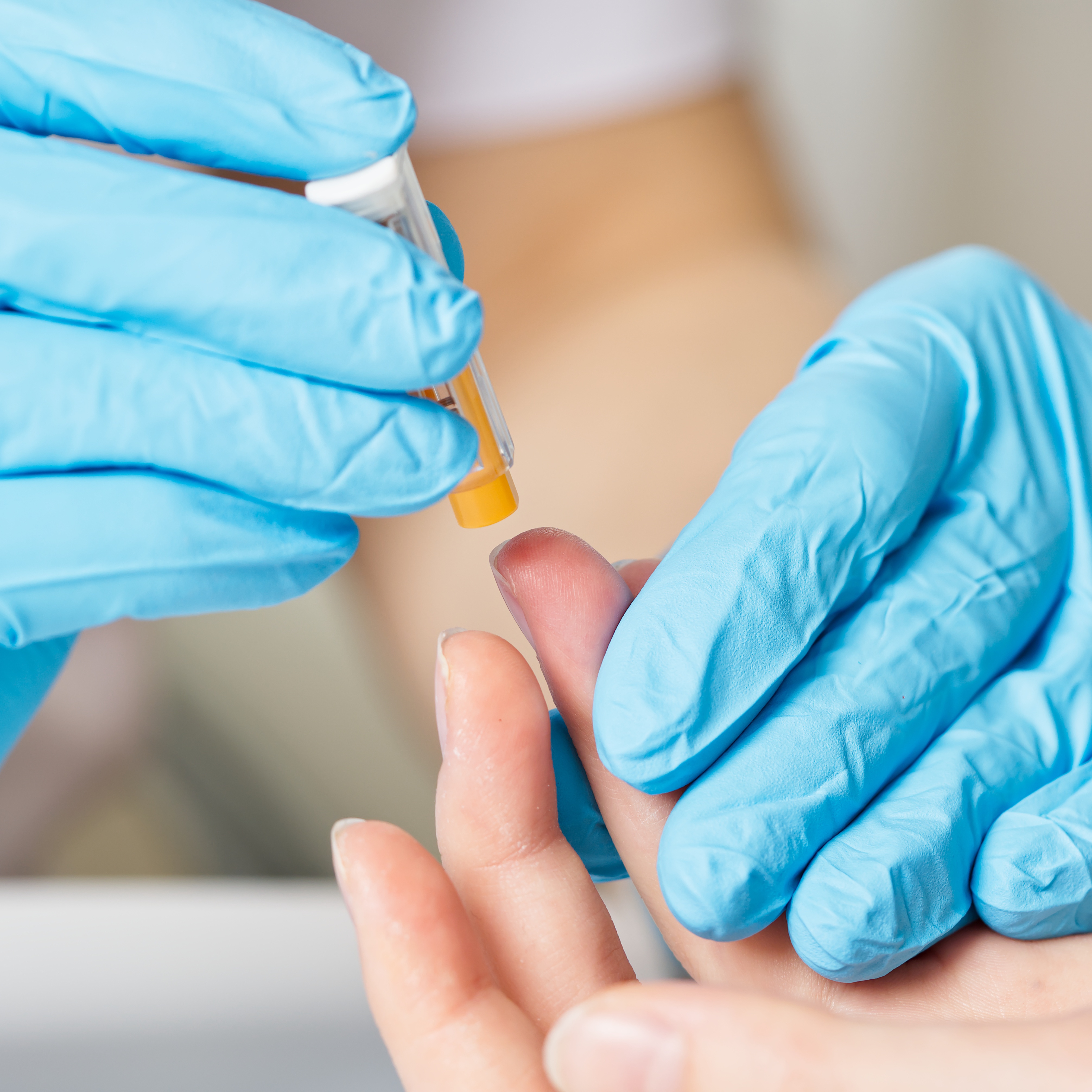Hematocrit & Hemoglobin Test at Give-A-Little More Lab Services & more in HOUSTON, TX