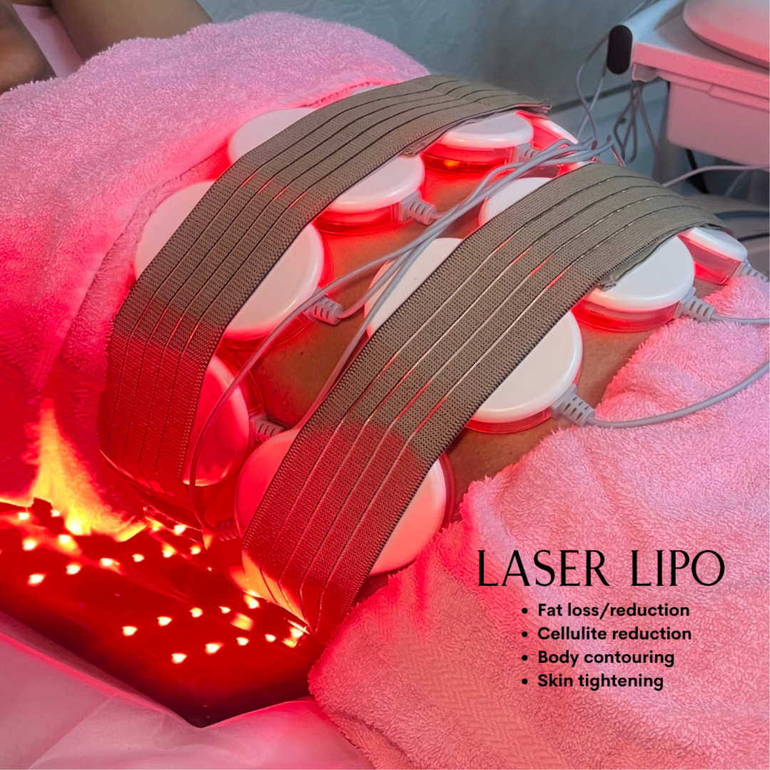 Quick Melt - Laser Lipo Treatment at To Cut & Dye For | Sculpted with Kare in Los Angeles, CA