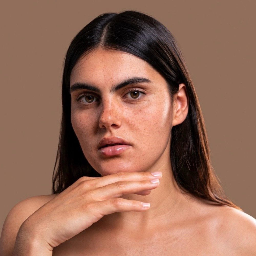 PCOS Facial Hair Reduction Consult at Youngevity Laser Skin Center in Pittsburgh, PA