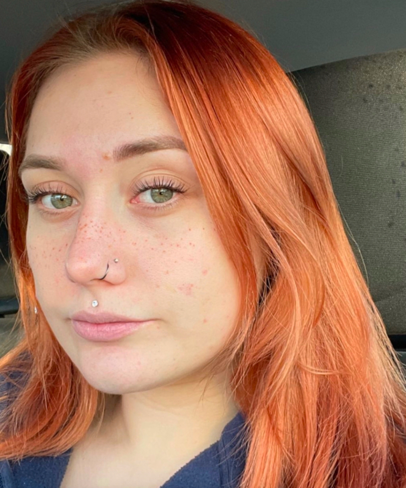 Tattooed Freckles