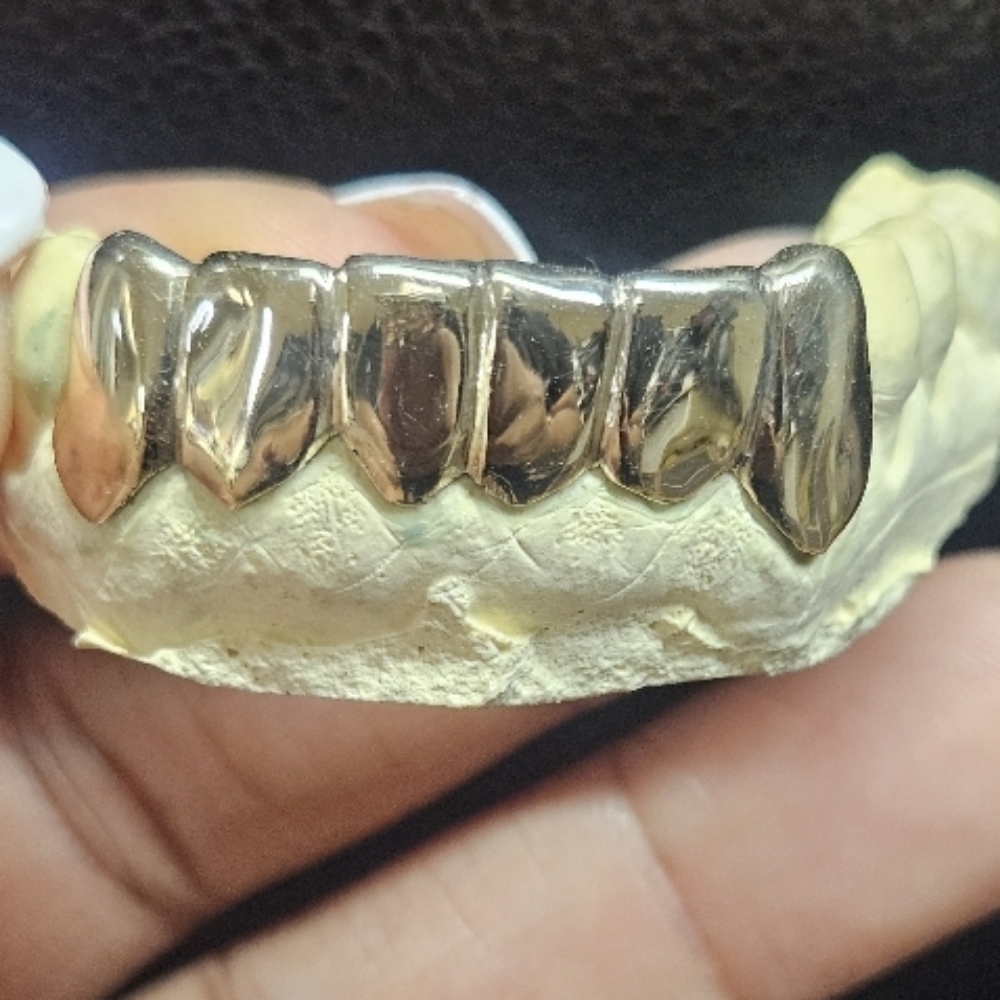 Gold Alloy Grillz at The Gold Standard in Indianapolis, IN