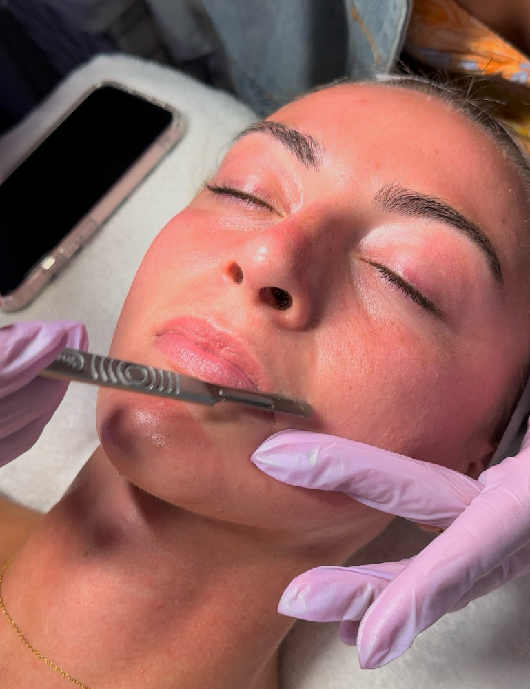Dermaplane Facial ✨