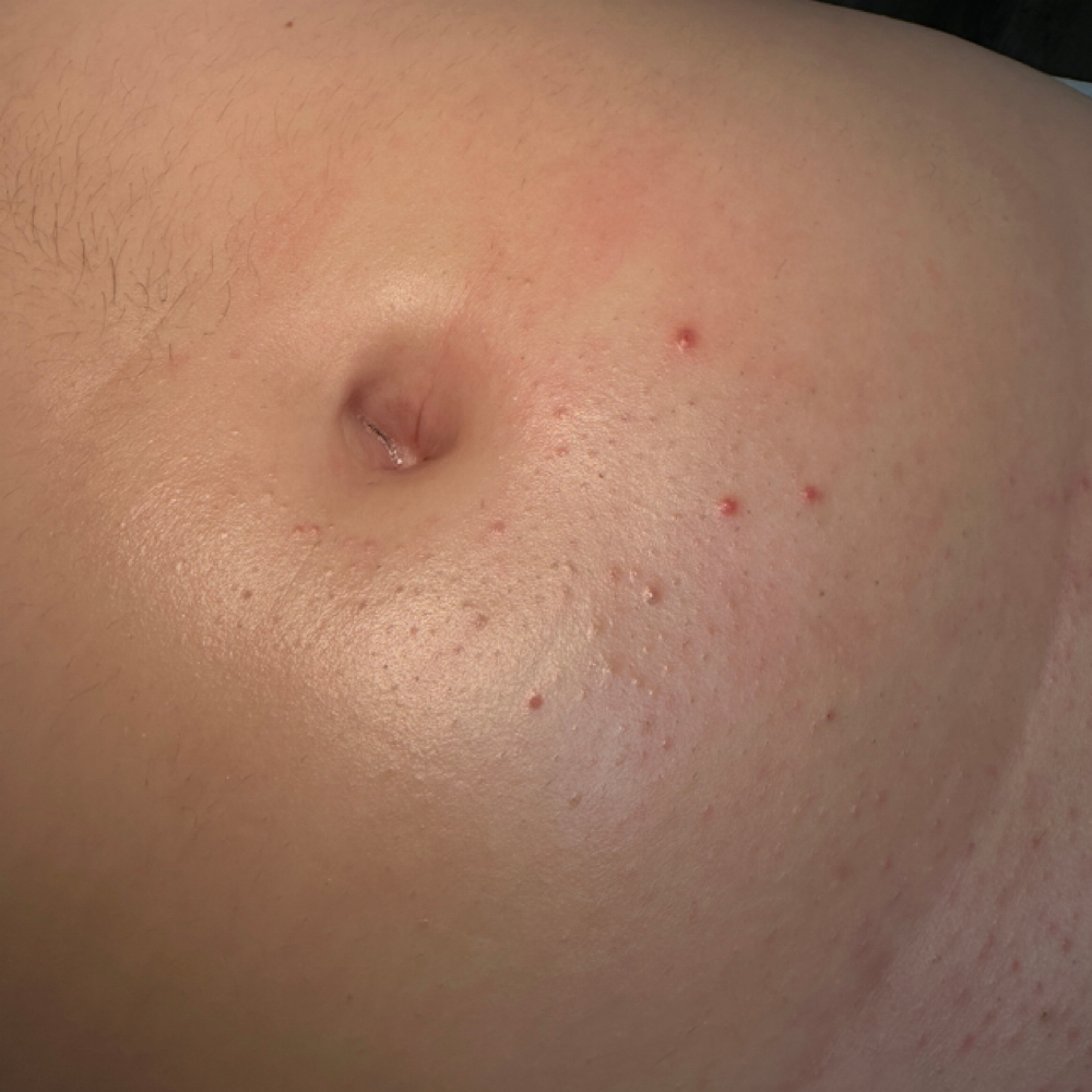 Lower Stomach at Sugar By Char in Corona, CA