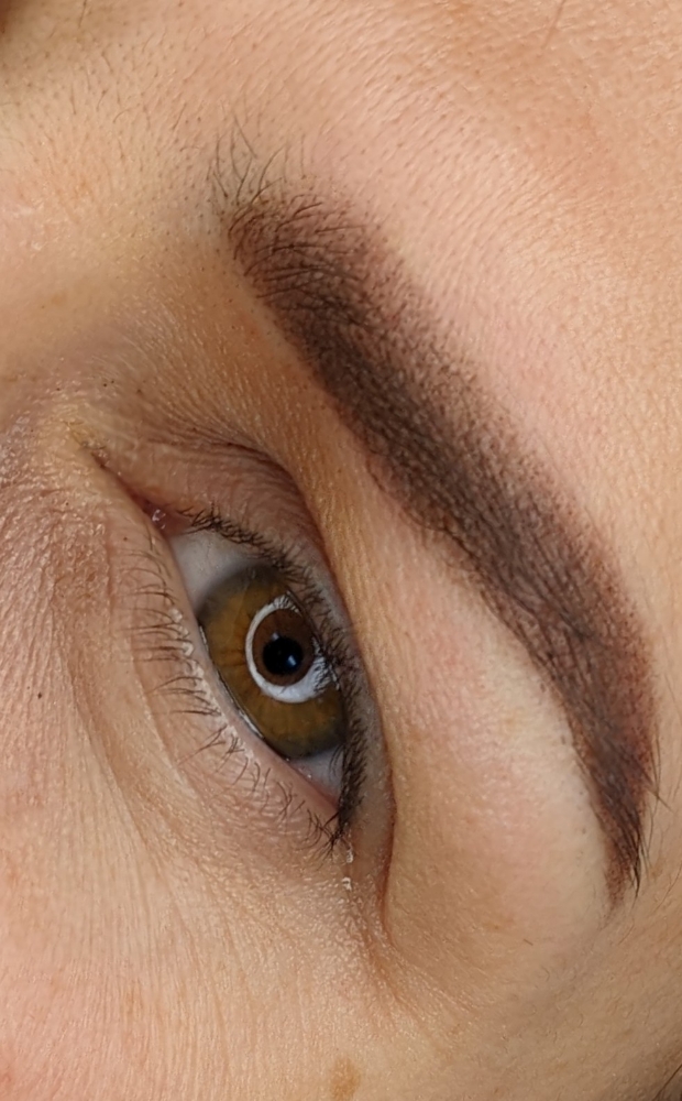 POWDER BROWS Initial Procedure