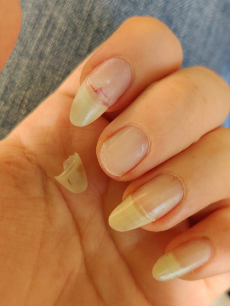 Nail Fix (each)