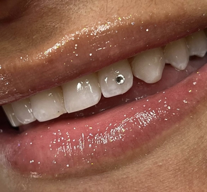The Tooth Jewelry (1)