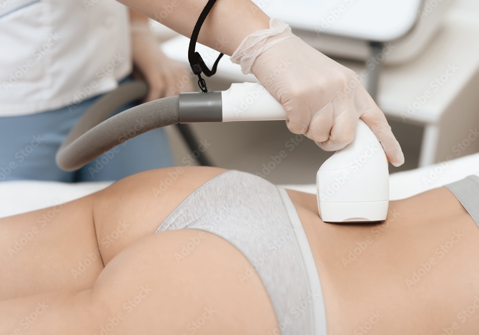 Lower Back Laser Hair Removal (sing