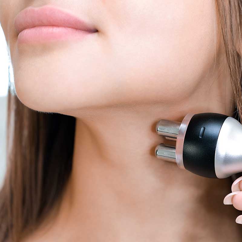 RF Facial (Double Chin)