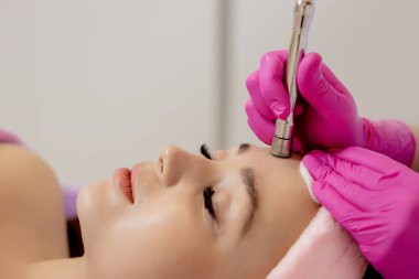 Microdermabrasion Facial